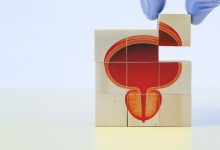 Quais as diferenças entre Holep e RTu de próstata
