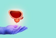 Dr. Marco Túlio Cruvinel, urologista em Goiânia, atende pacientes de Brasília com técnica HoLEP para tratar a próstata aumentada