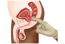 Dr. Marco Túlio Cruvinel, urologista em Goiânia, atende pacientes de Brasília e explica as etapas para diagnosticar o câncer de próstata com precisão