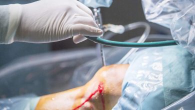 Sutura do menisco quando ela é indicada